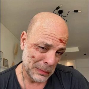 Bruce Willis’ wife Emma Heming shares heartbreaking video of him after his dementia diagnosis Bruce Willis’ wife Emma Heming shares heartbreaking video of him after his dementia diagnosis