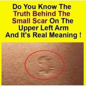 Do You Know The Real Significance Of The Small Scar